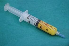 Xiringa con tecido adiposo para cirurxía de ampliación do pene